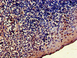 Immunohistochemistry of paraffin-embedded human tonsil tissue using TRADD Antibody at dilution of 1:100Rabbit anti-Human TRADD Polyclonal Antibody