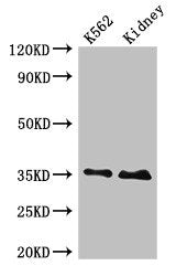 Western Blot | Positive WB detected in: K562 whole cell lysate, Rat kidney tissue | All lanes: TRADD antibody at 4μg/ml | Secondary | Goat polyclonal to rabbit IgG at 1/50000 dilution | Predicted band size: 35, 28 kDa | Observed band size: 35 kDaRabbit anti-Human TRADD Polyclonal Antibody