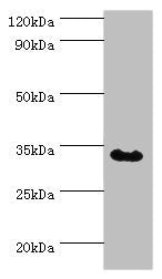 Western blot | All lanes: Tumor necrosis factor receptor type 1-associated DEATH domain protein antibody at 12μg/ml + MCF-7 whole cell lysate | Secondary | Goat polyclonal to rabbit IgG at 1/10000 dilution | Predicted band size: 35, 28 kDa | Observed band size: 35 kDaRabbit anti-Human TRADD Polyclonal Antibody