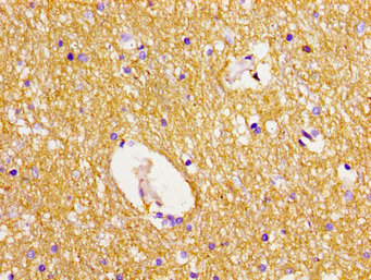 Immunohistochemistry of paraffin-embedded human brain tissue using DLG2 Antibody at dilution of 1:100Rabbit anti-Human DLG2 Polyclonal Antibody