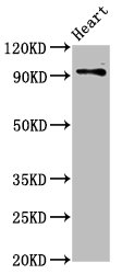 Western Blot | Positive WB detected in: Rat heart tissue | All lanes: DLG2 antibody at 2.8μg/ml | Secondary | Goat polyclonal to rabbit IgG at 1/50000 dilution | Predicted band size: 98, 110, 84, 101, 39 kDa | Observed band size: 98 kDaRabbit anti-Human DLG2 Polyclonal Antibody