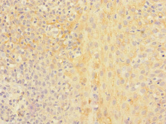 Immunohistochemistry of paraffin-embedded human tonsil tissue using CHRNA2 Antibody at dilution of 1:100Rabbit anti-Human CHRNA2 Polyclonal Antibody