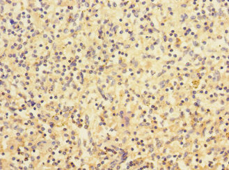 Immunohistochemistry of paraffin-embedded human spleen tissue using CHRNA2 Antibody at dilution of 1:100Rabbit anti-Human CHRNA2 Polyclonal Antibody