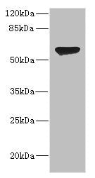 Western blot  | All lanes: CHRNA2 antibody at 2.41µg/ml + HL60 whole cell lysate  | Secondary  | Goat polyclonal to rabbit IgG at 1/10000 dilution  | Predicted band size: 60, 59 kDa  | Observed band size: 60 kDaRabbit anti-Human CHRNA2 Polyclonal Antibody