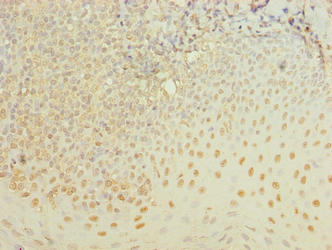 Immunohistochemistry of paraffin-embedded human tonsil tissue using ZBTB6 Antibody at dilution of 1:100Rabbit anti-Human ZBTB6 Polyclonal Antibody