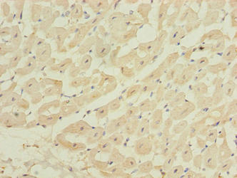 Immunohistochemistry of paraffin-embedded human heart tissue using ZBTB6 Antibody at dilution of 1:100Rabbit anti-Human ZBTB6 Polyclonal Antibody