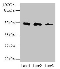 Western blot  | All lanes: ZBTB6 antibody at 8µg/ml  | Lane 1: Hela whole cell lysate  | Lane 2: HepG2 whole cell lysate  | Lane 3: 293T whole cell lysate  | Secondary  | Goat polyclonal to rabbit IgG at 1/10000 dilution  | Predicted band size: 49 kDa  | Observed band size: 49 kDaRabbit anti-Human ZBTB6 Polyclonal Antibody