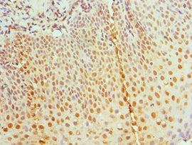 Immunohistochemistry of paraffin-embedded human tonsil tissue using RBBP7 Antibody at dilution of 1:100Rabbit anti-Human RBBP7 Polyclonal Antibody