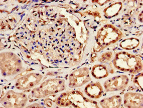 Immunohistochemistry of paraffin-embedded human kidney tissue using CPSF6 Antibody at dilution of 1:100Rabbit anti-Human CPSF6 Polyclonal Antibody