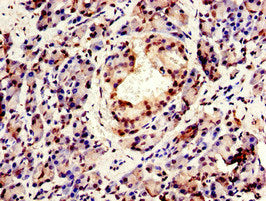 Immunohistochemistry of paraffin-embedded human pancreatic tissue using CPSF6 Antibody at dilution of 1:100Rabbit anti-Human CPSF6 Polyclonal Antibody