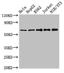 Western Blot | Positive WB detected in: Hela whole cell lysate, HepG2 whole cell lysate, K562 whole cell lysate, Jurkat whole cell lysate, NIH/3T3 whole cell lysate | All lanes: CPSF6 antibody at 3μg/ml | Secondary | Goat polyclonal to rabbit IgG at 1/50000 dilution | Predicted band size: 60, 64, 53 kDa | Observed band size: 60 kDaRabbit anti-Human CPSF6 Polyclonal Antibody
