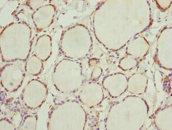 Immunohistochemistry of paraffin-embedded human thyroid tissue using NFIL3 Antibody at dilution of 1:100Rabbit anti-Human NFIL3 Polyclonal Antibody