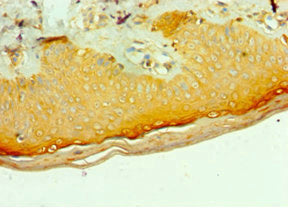 Immunohistochemistry of paraffin-embedded human skin tissue using MLANA Antibody at dilution of 1:100Rabbit anti-Human MLANA Polyclonal Antibody