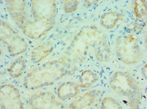 Immunohistochemistry of paraffin-embedded human kidney tissue using MLANA Antibody at dilution of 1:100Rabbit anti-Human MLANA Polyclonal Antibody