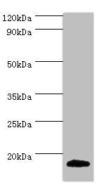 Western blot | All lanes: MLANA antibody at 2μg/ml + Mouse eye tissue | Secondary | Goat polyclonal to rabbit IgG at 1/10000 dilution | Predicted band size: 13 kDa | Observed band size: 13 kDa