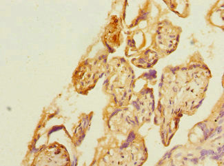 Immunohistochemistry of paraffin-embedded human placenta tissue using KYNU Antibody at dilution of 1:100
