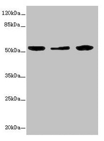Western blot | All lanes: KYNU antibody at 3.26μg/ml | Lane 1: A549 whole cell lysate | Lane 2: HepG2 whole cell lysate | Lane 3: THP-1 whole cell lysate | Secondary | Goat polyclonal to rabbit IgG at 1/10000 dilution | Predicted band size: 53, 35 kDa | Observed band size: 53 kDa