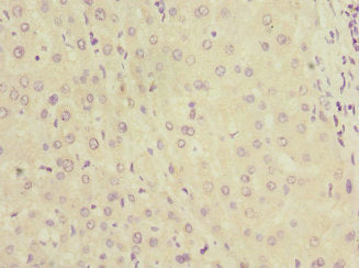 Immunohistochemistry of paraffin-embedded human liver tissue using KYNU Antibody at dilution of 1:100