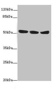 Western blot | All lanes: KYNU antibody at 1.44μg/ml | Lane 1: A549 whole cell lysate | Lane 2: HepG2 whole cell lysate | Lane 3: Hela whole cell lysate | Secondary | Goat polyclonal to rabbit IgG at 1/10000 dilution | Predicted band size: 53, 35 kDa | Observed band size: 53 kDa