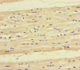 Immunohistochemistry of paraffin-embedded human heart tissue using KYNU Antibody at dilution of 1:100