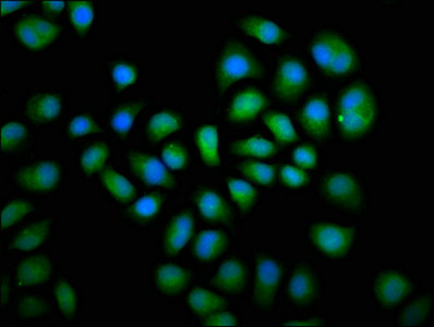 Immunofluorescence staining of Hela cells with DUSP6 Antibody at 1:66, counter-stained with DAPI. The cells were fixed in 4% formaldehyde, permeabilized using 0.2% Triton X-100 and blocked in 10% normal Goat Serum. The cells were then incubated with the antibody overnight at 4°C. The secondary antibody was Alexa Fluor 488-congugated AffiniPure Goat Anti-Rabbit IgG(H+L).Rabbit anti-Human DUSP6 Polyclonal Antibody