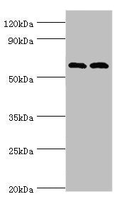 Western blot | All lanes: Serine/threonine-protein kinase PAK 2 antibody at 2μg/ml | Lane 1: Jurkat whole cell lysate | Lane 2: Hela whole cell lysate | Secondary | Goat polyclonal to rabbit IgG at 1/10000 dilution | Predicted band size: 58 kDa | Observed band size: 58 kDaRabbit anti-Human PAK2 Polyclonal Antibody