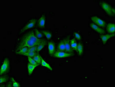 Immunofluorescent analysis of HepG2 cells using MYO7A Antibody at dilution of 1:100 and Alexa Fluor 488-congugated AffiniPure Goat Anti-Rabbit IgG(H+L)Rabbit anti-Human MYO7A Polyclonal Antibody