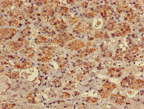 Immunohistochemistry of paraffin-embedded human adrenal gland tissue using MYO7A Antibody at dilution of 1:100Rabbit anti-Human MYO7A Polyclonal Antibody