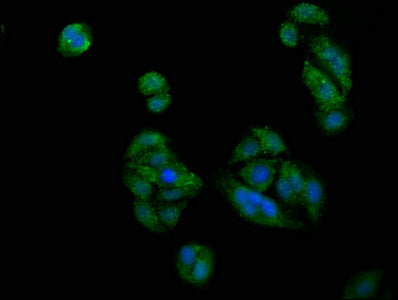 Immunofluorescence staining of HepG2 cells with PICALM Antibody at 1:200, counter-stained with DAPI. The cells were fixed in 4% formaldehyde, permeabilized using 0.2% Triton X-100 and blocked in 10% normal Goat Serum. The cells were then incubated with the antibody overnight at 4°C. The secondary antibody was Alexa Fluor 488-congugated AffiniPure Goat Anti-Rabbit IgG(H+L).Rabbit anti-Human PICALM Polyclonal Antibody