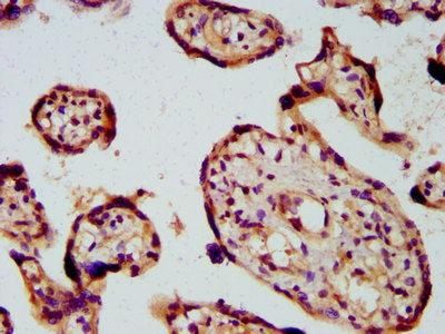 IHC image of the antibody diluted at 1:600 and staining in paraffin-embedded human placenta tissue performed on a Leica BondTM system. After dewaxing and hydration, antigen retrieval was mediated by high pressure in a citrate buffer (pH 6.0). Section was blocked with 10% normal goat serum 30min at RT. Then primary antibody (1% BSA) was incubated at 4°C overnight. The primary is detected by a biotinylated secondary antibody and visualized using an HRP conjugated SP system.Rabbit anti-Human PICALM Polyclonal Antibody