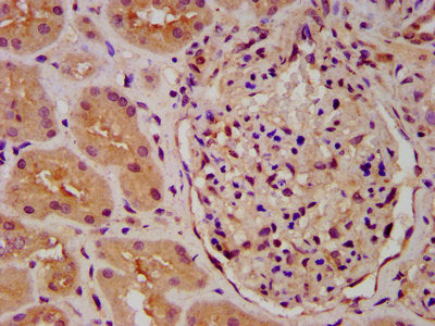 IHC image of PICALM Antibody diluted at 1:600 and staining in paraffin-embedded human kidney tissue performed on a Leica BondTM system. After dewaxing and hydration, antigen retrieval was mediated by high pressure in a citrate buffer (pH 6.0). Section was blocked with 10% normal goat serum 30min at RT. Then primary antibody (1% BSA) was incubated at 4°C overnight. The primary is detected by a biotinylated secondary antibody and visualized using an HRP conjugated SP system.Rabbit anti-Human PICALM Polyclonal Antibody