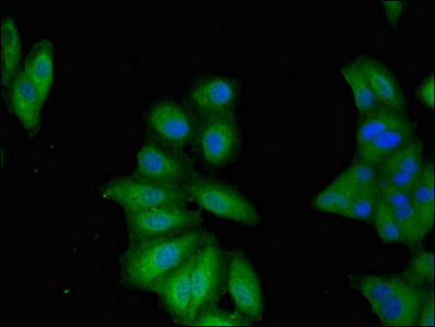 Immunofluorescent analysis of Hela cells using TNFAIP1 Antibody at dilution of 1:100 and Alexa Fluor 488-congugated AffiniPure Goat Anti-Rabbit IgG(H+L)Rabbit anti-Human TNFAIP1 Polyclonal Antibody