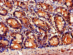 Immunohistochemistry of paraffin-embedded human small intestine tissue using the antibody at dilution of 1:100Rabbit anti-Human TNFAIP1 Polyclonal Antibody