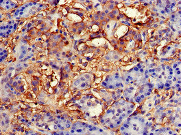 Immunohistochemistry of paraffin-embedded human pancreatic tissue using TNFAIP1 Antibody at dilution of 1:100Rabbit anti-Human TNFAIP1 Polyclonal Antibody