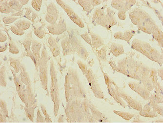 Immunohistochemistry of paraffin-embedded human heart tissue using KLF9 Antibody at dilution of 1:100