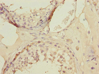 Immunohistochemistry of paraffin-embedded human testis tissue using KLF9 Antibody at dilution of 1:100
