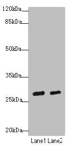 Western blot | All lanes: KLF9antibody at 4.43μg/ml | Lane 1: Mouse kidney tissue | Lane 2: Mouse liver tissue | Secondary | Goat polyclonal to rabbit IgG at 1/10000 dilution | Predicted band size: 27 kDa | Observed band size: 27 kDa
