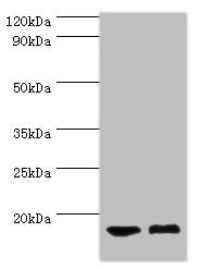 Western blot | All lanes: COTL1 antibody at 5μg/ml | Lane 1: Mouse brain tissue | Lane 2: Mouse kidney tissue | Secondary | Goat polyclonal to rabbit IgG at 1/10000 dilution | Predicted band size: 16 kDa | Observed band size: 16 kDaRabbit anti-Human COTL1 Polyclonal Antibody