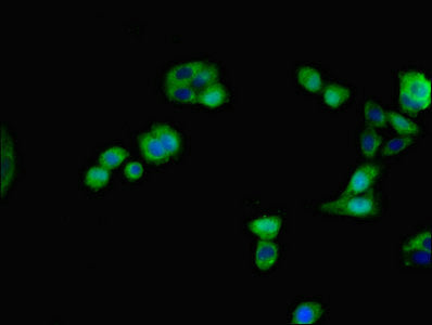 Immunofluorescent analysis of HepG2 cells using IHH Antibody at dilution of 1:100 and Alexa Fluor 488-congugated AffiniPure Goat Anti-Rabbit IgG(H+L)