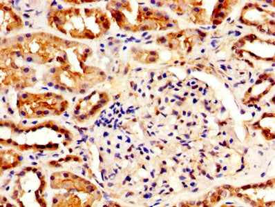 IHC image of IHH Antibody diluted at 1:500 and staining in paraffin-embedded human kidney tissue performed on a Leica BondTM system. After dewaxing and hydration, antigen retrieval was mediated by high pressure in a citrate buffer (pH 6.0). Section was blocked with 10% normal goat serum 30min at RT. Then primary antibody (1% BSA) was incubated at 4°C overnight. The primary is detected by a biotinylated secondary antibody and visualized using an HRP conjugated SP system.
