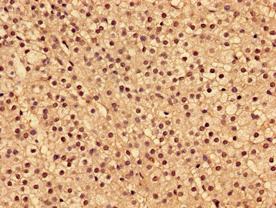 Immunohistochemistry of paraffin-embedded human adrenal gland tissue using INPP5A Antibody at dilution of 1:100