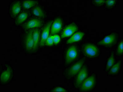 Immunofluorescence staining of A549 cells with CRYM Antibody at 1:166, counter-stained with DAPI. The cells were fixed in 4% formaldehyde, permeabilized using 0.2% Triton X-100 and blocked in 10% normal Goat Serum. The cells were then incubated with the antibody overnight at 4°C. The secondary antibody was Alexa Fluor 488-congugated AffiniPure Goat Anti-Rabbit IgG(H+L).Rabbit anti-Human CRYM Polyclonal Antibody
