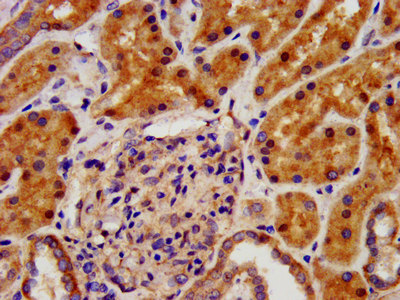 IHC image of the antibody diluted at 1:500 and staining in paraffin-embedded human kidney tissue performed on a Leica BondTM system. After dewaxing and hydration, antigen retrieval was mediated by high pressure in a citrate buffer (pH 6.0). Section was blocked with 10% normal goat serum 30min at RT. Then primary antibody (1% BSA) was incubated at 4°C overnight. The primary is detected by a biotinylated secondary antibody and visualized using an HRP conjugated SP system.Rabbit anti-Human CRYM Polyclonal Antibody