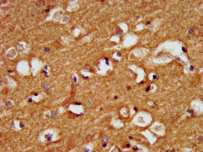 IHC image of CRYM Antibody diluted at 1:500 and staining in paraffin-embedded human brain tissue performed on a Leica BondTM system. After dewaxing and hydration, antigen retrieval was mediated by high pressure in a citrate buffer (pH 6.0). Section was blocked with 10% normal goat serum 30min at RT. Then primary antibody (1% BSA) was incubated at 4°C overnight. The primary is detected by a biotinylated secondary antibody and visualized using an HRP conjugated SP system.Rabbit anti-Human CRYM Polyclonal Antibody