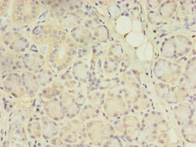 Immunohistochemistry of paraffin-embedded human pancreatic tissue using ACAP1 Antibody at dilution of 1:100Rabbit anti-Human ACAP1 Polyclonal Antibody