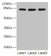 Western blot  | All lanes: ACAP1 antibody at 4µg/ml  | Lane 1: Mouse lung tissue  | Lane 2: Jurkat whole cell lysate  | Lane 3: K562 whole cell lysate  | Secondary  | Goat polyclonal to rabbit IgG at 1/10000 dilution  | Predicted band size: 82 kDa  | Observed band size: 82 kDa