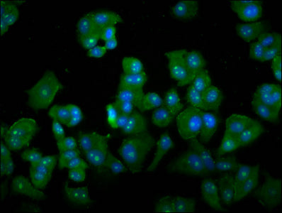 Immunofluorescence staining of MCF-7 cells with DAZAP2 Antibody at 1:133, counter-stained with DAPI. The cells were fixed in 4% formaldehyde, permeabilized using 0.2% Triton X-100 and blocked in 10% normal Goat Serum. The cells were then incubated with the antibody overnight at 4°C. The secondary antibody was Alexa Fluor 488-congugated AffiniPure Goat Anti-Rabbit IgG(H+L).Rabbit anti-Human DAZAP2 Polyclonal Antibody