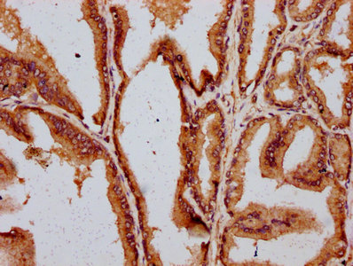 IHC image of DAZAP2 Antibody diluted at 1:400 and staining in paraffin-embedded human prostate tissue performed on a Leica BondTM system. After dewaxing and hydration, antigen retrieval was mediated by high pressure in a citrate buffer (pH 6.0). Section was blocked with 10% normal goat serum 30min at RT. Then primary antibody (1% BSA) was incubated at 4°C overnight. The primary is detected by a biotinylated secondary antibody and visualized using an HRP conjugated SP system.Rabbit anti-Human DAZAP2 Polyclonal Antibody