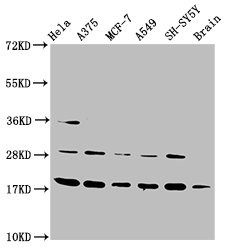 Western Blot  | Positive WB detected in: Hela whole cell lysate, A375 whole cell lysate, MCF-7 whole cell lysate, A549 whole cell lysate, SH-SY5Y whole cell lysate, Rat brain tissue  | All lanes: DAZAP2 antibody at 3.5µg/ml  | Secondary  | Goat polyclonal to rabbit IgG at 1/50000 dilution  | Predicted band size: 18, 17, 16, 14, 10, 23 kDa  | Observed band size: 18 kDaRabbit anti-Human DAZAP2 Polyclonal Antibody