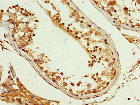 IHC image of PCBP2 Antibody diluted at 1:200 and staining in paraffin-embedded human testis tissue performed on a Leica BondTM system. After dewaxing and hydration, antigen retrieval was mediated by high pressure in a citrate buffer (pH 6.0). Section was blocked with 10% normal goat serum 30min at RT. Then primary antibody (1% BSA) was incubated at 4°C overnight. The primary is detected by a biotinylated secondary antibody and visualized using an HRP conjugated SP system.Rabbit anti-Human PCBP2 Polyclonal Antibody